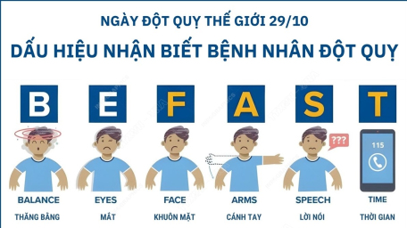 Ngày Đột quỵ thế giới 29/10: Dấu hiệu nhận biết bệnh nhân đột quỵ BE FAST